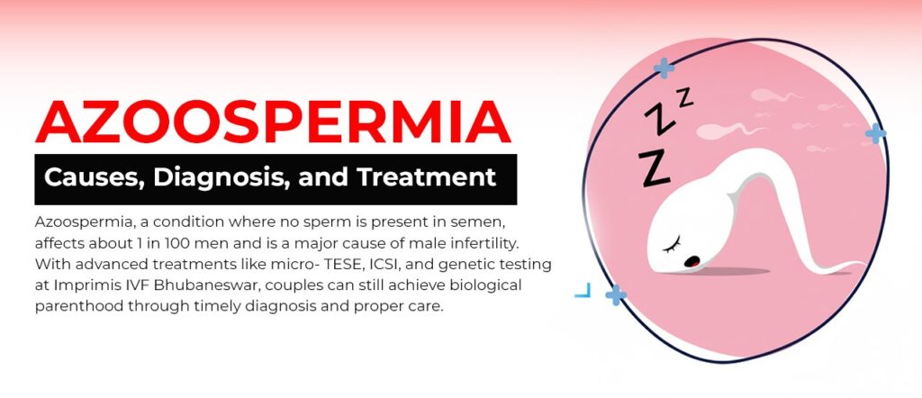 Azoospermia - causes, diagnosis, and treatment