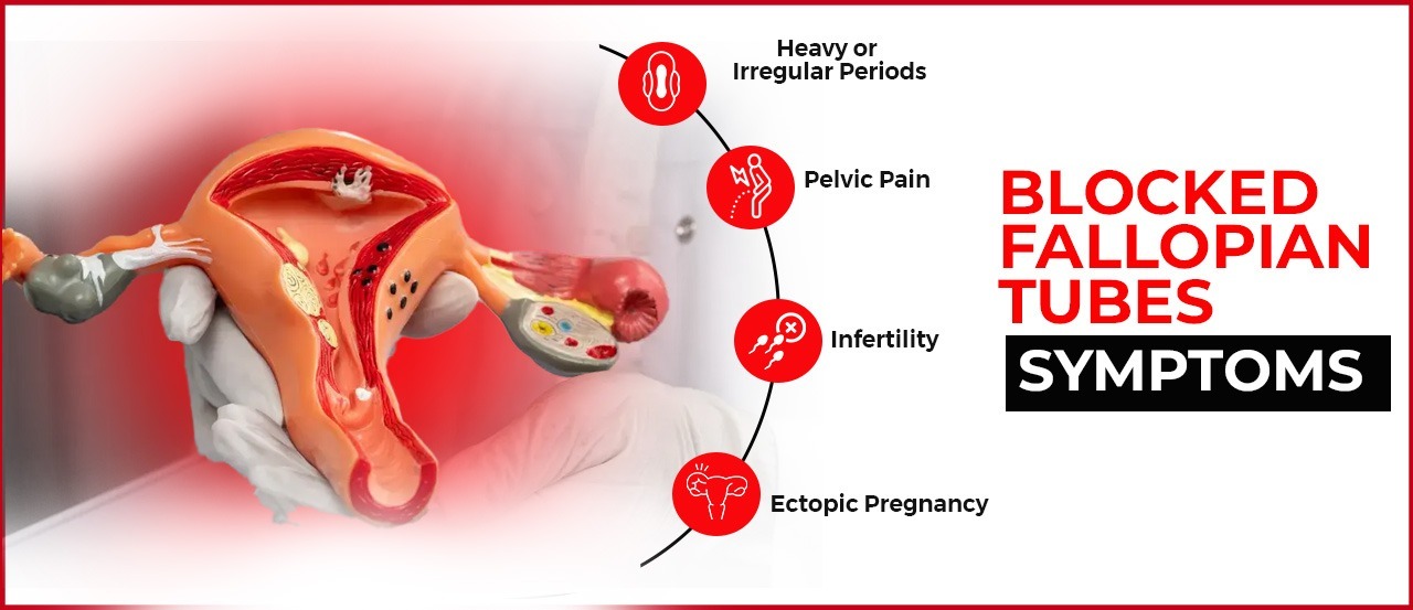 Symptoms of Blocked Fallopian Tubes